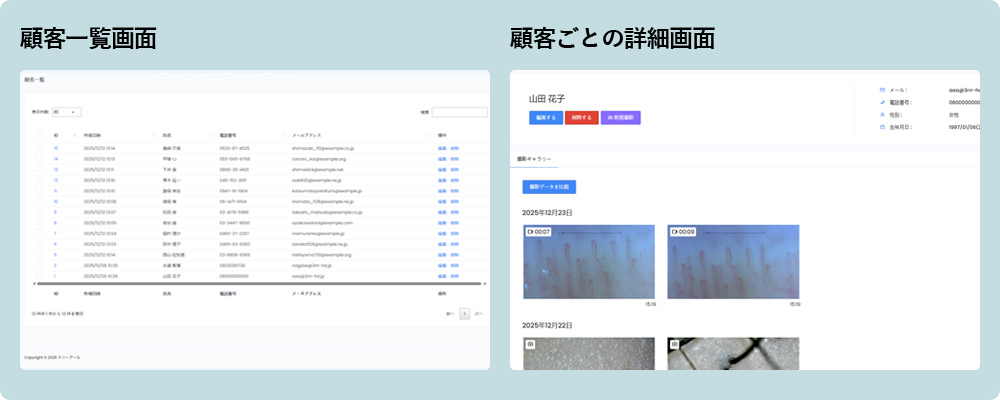 施術前後の動画比較画面