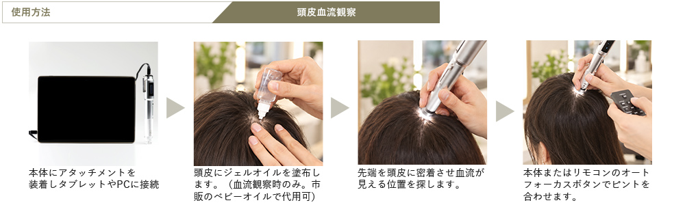 使用方法 頭皮血流観察